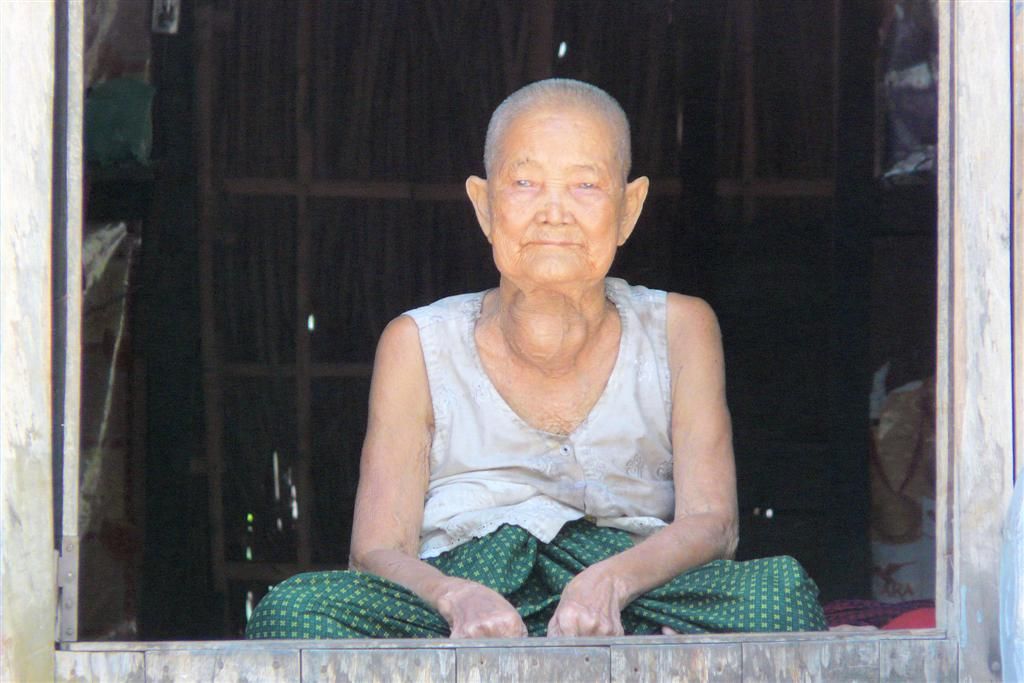 CAMBODJA - SIEM REAP -> PHNOM PENH - oudere vrouw met gezwel in haar nek