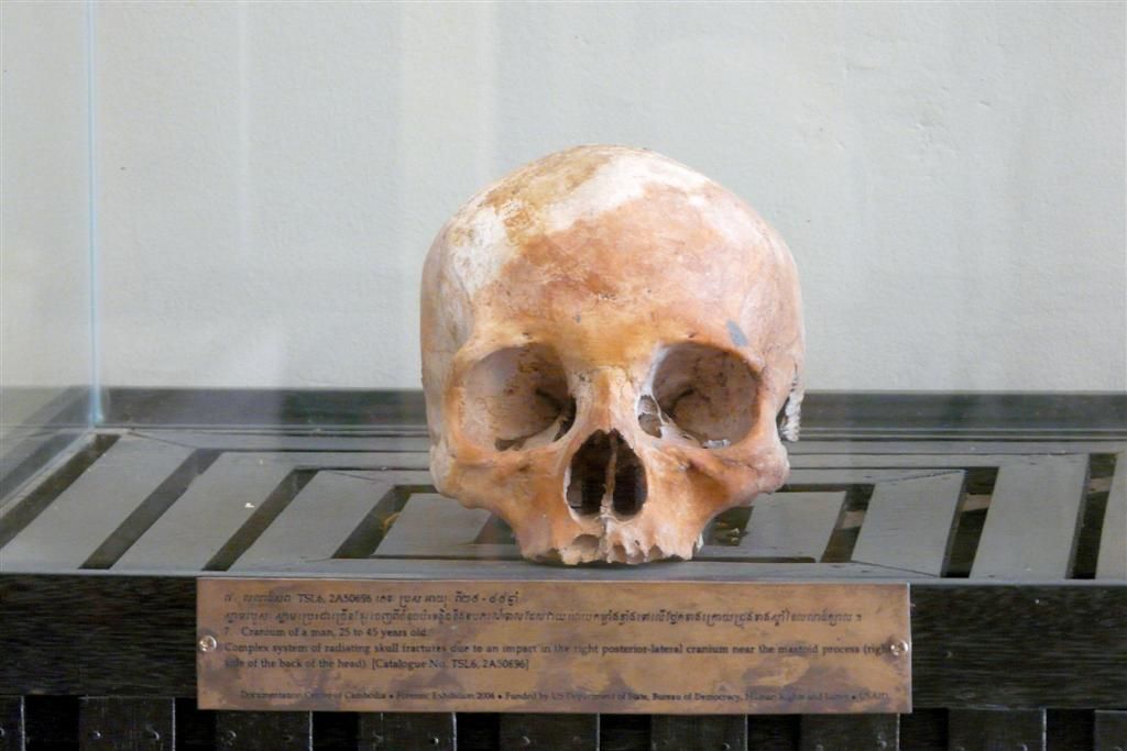 CAMBODJA - PHNOM PENH - schedel van slachtoffer van rode Khmer in het Tuol Sleng Genocide museum